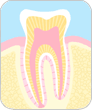 健常な歯